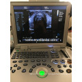 DW-C60plus portátil 3D 4D color doppler máquina de ultrasonido con aprobación CE